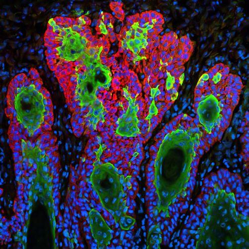 Cell Segmentation Course thumbnail image