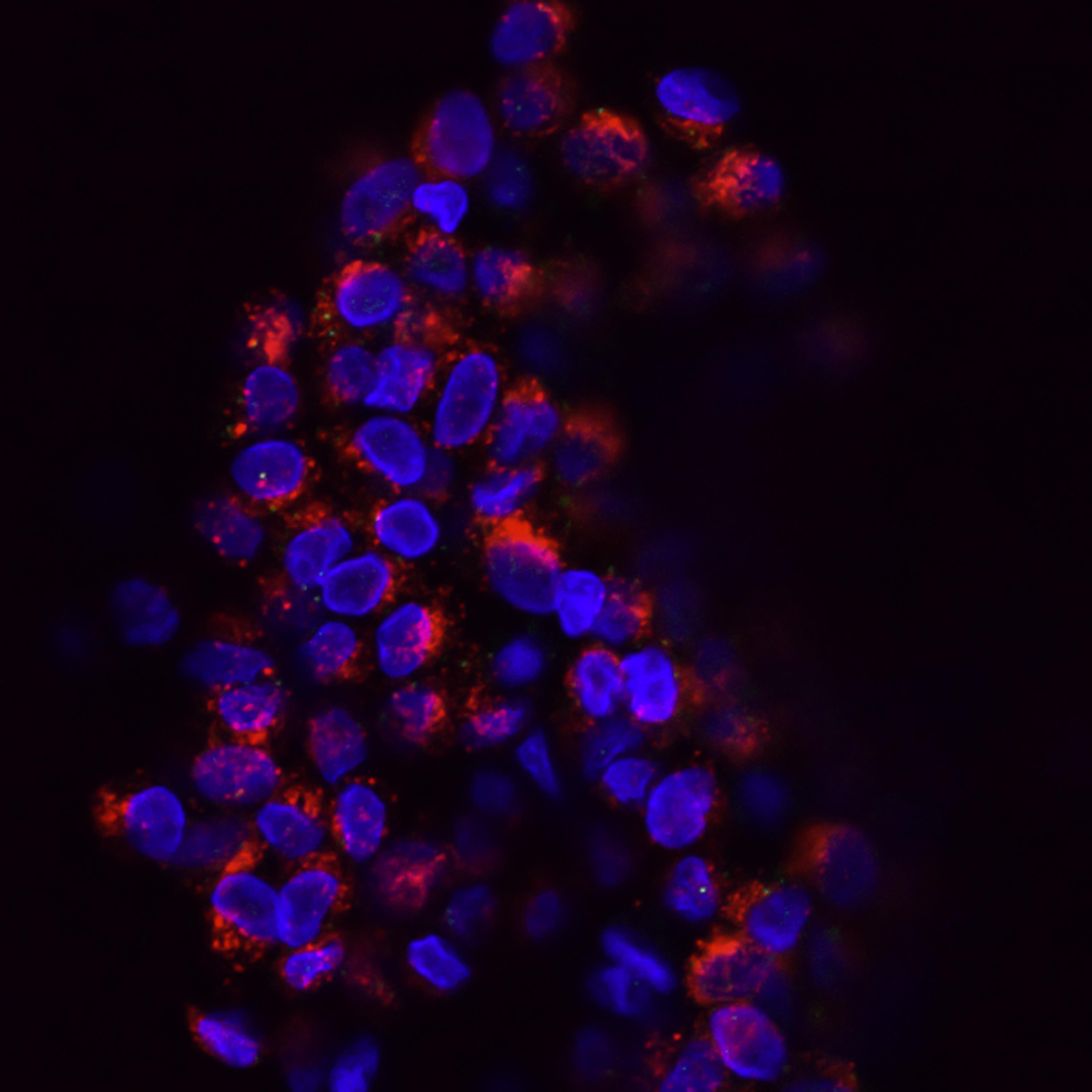 Cell Segmentation Course cover image